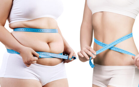 What Factors Affect Your Weight Loss Program? 